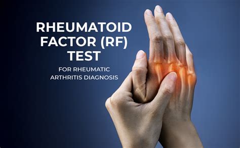 rheumatoid arthritis rf testing